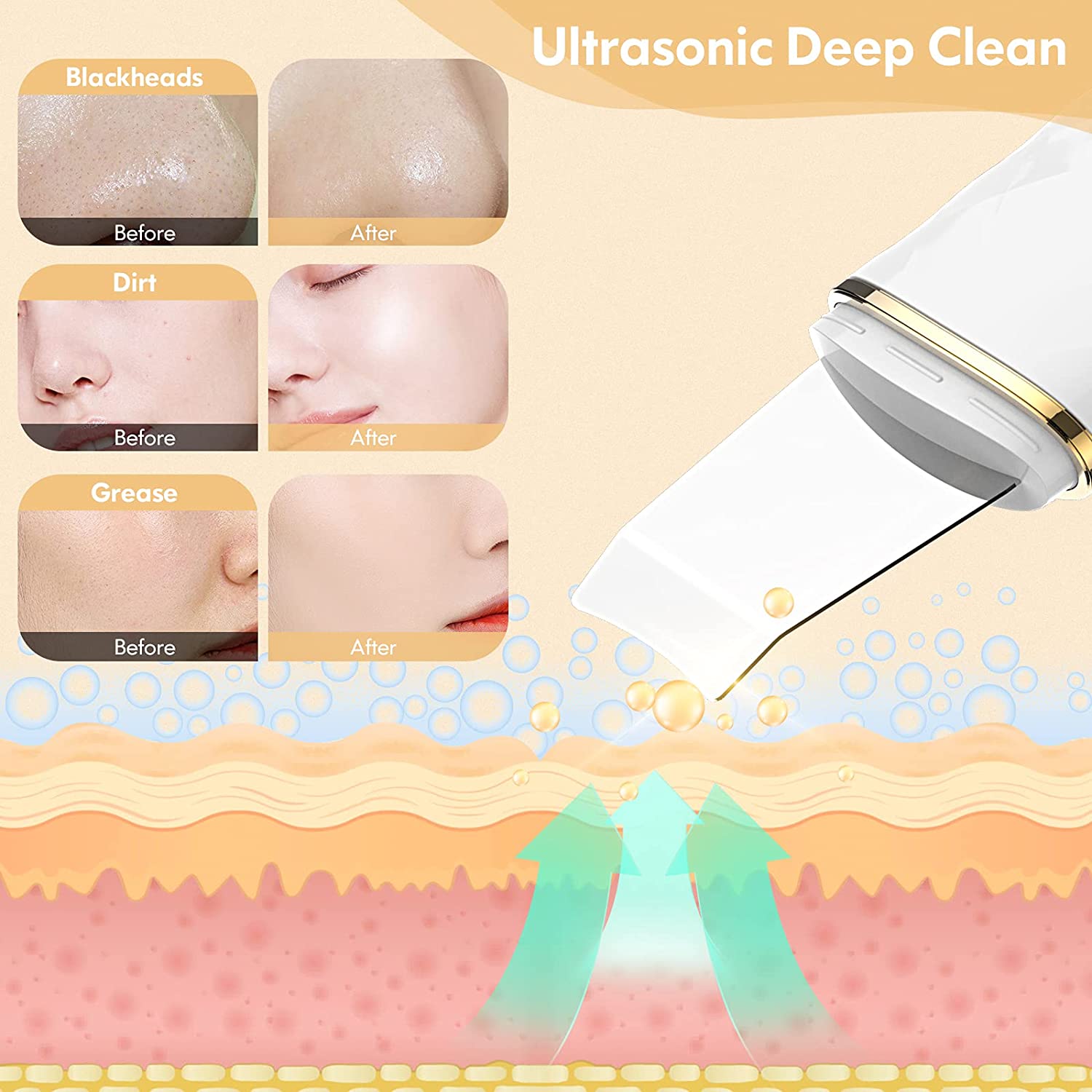 Limpiador Facial Ultrasonico Espatula con set de regalo